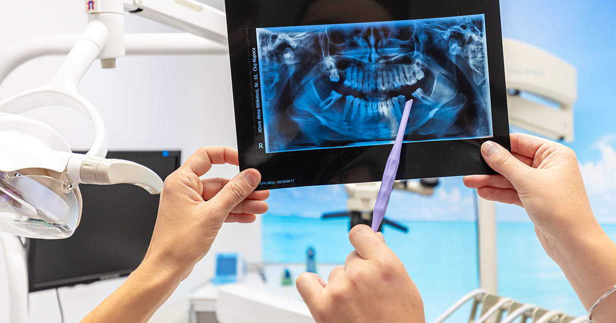 dental-texture-dintelipsablog